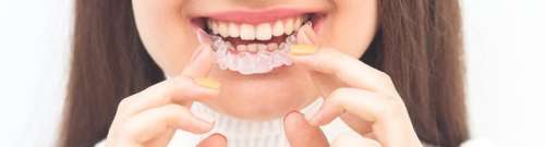 戴牙套矫正牙齿一般需要多少钱？